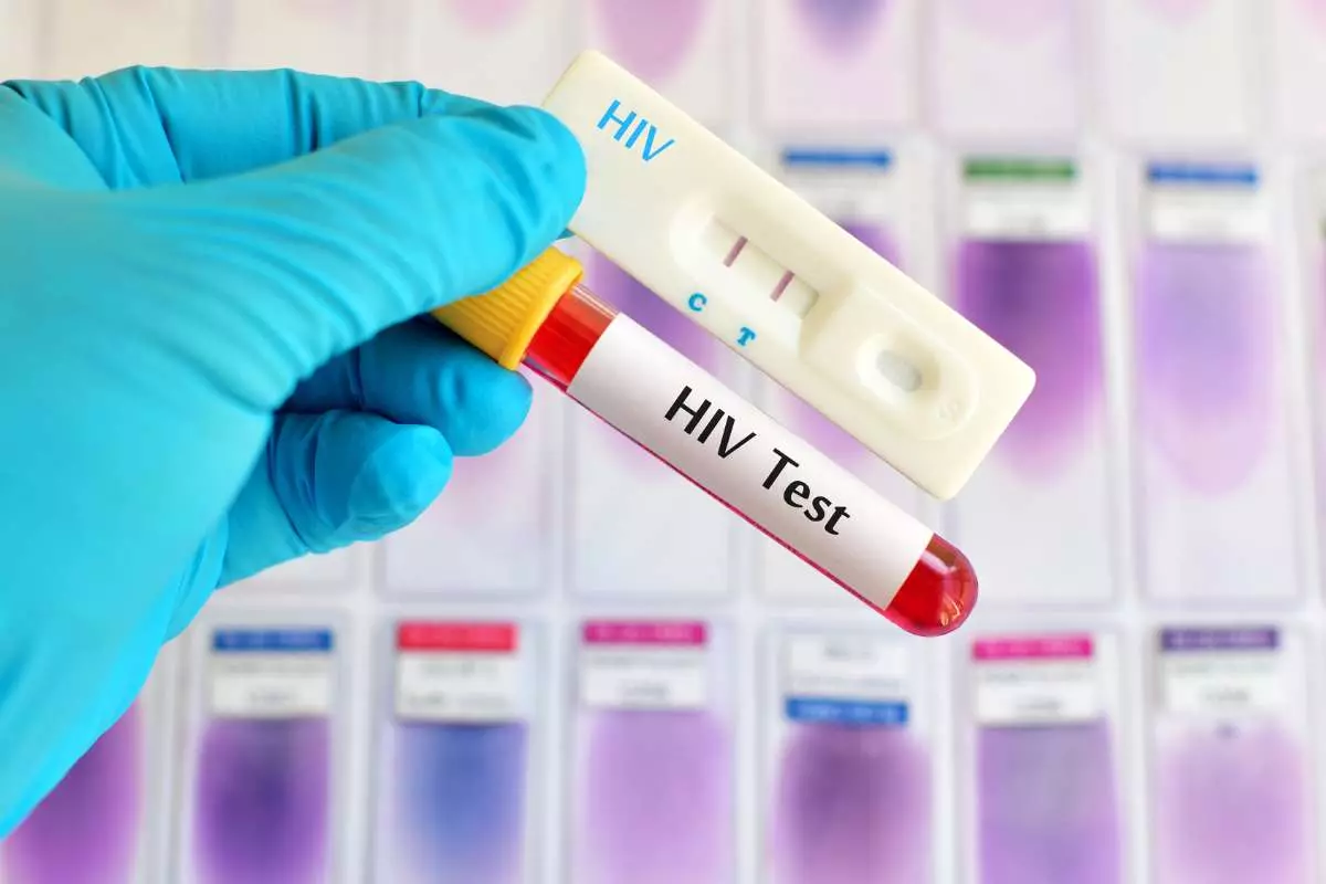 Periksa Sifilis dan HIV Secara Teratur