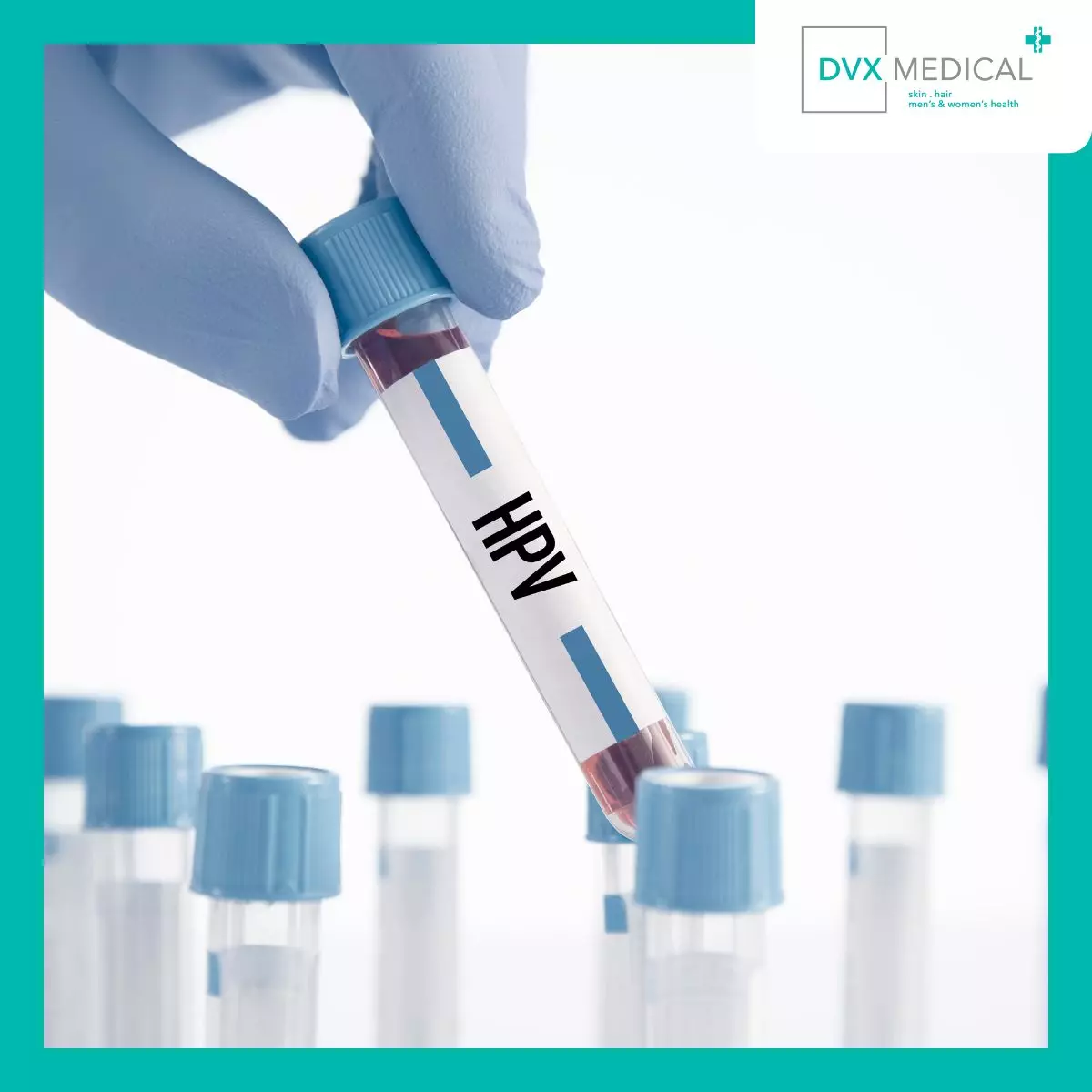 Manfaat Tes HPV DNA Genotyping