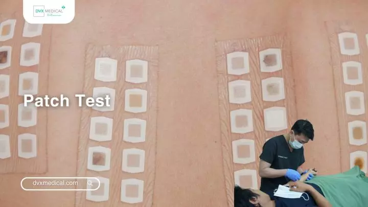 Patch Test