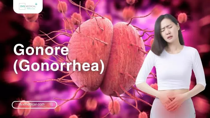 Gonore (Gonorrhea)