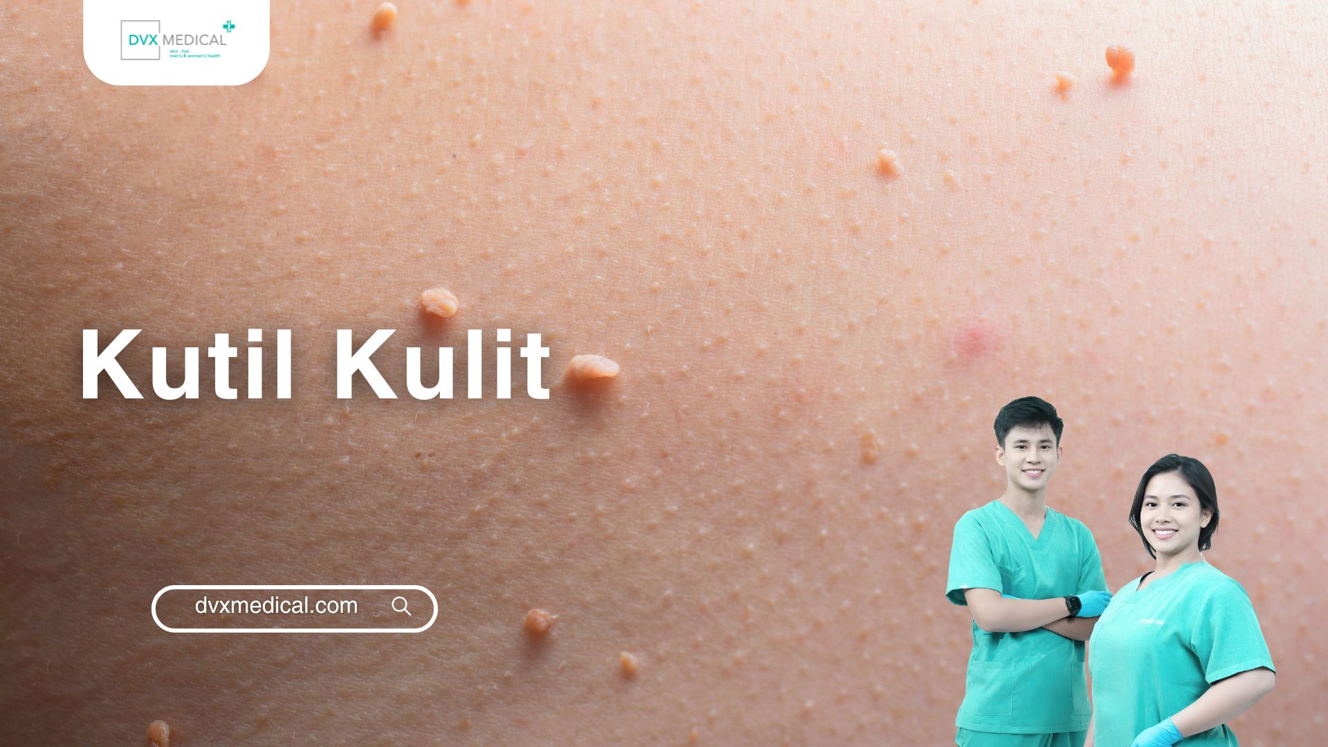 Kutil Kulit