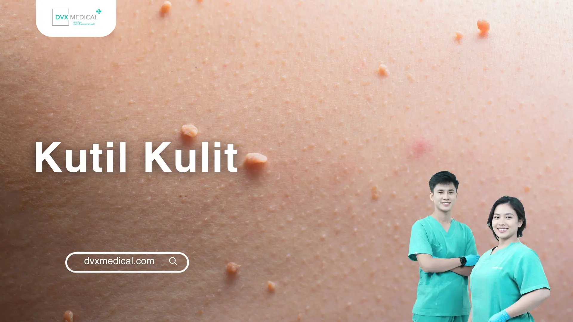 Kutil Kulit