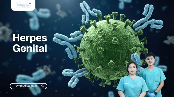 Herpes Genital