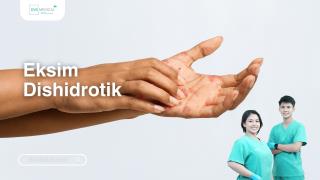 Eksim Dishidrotik