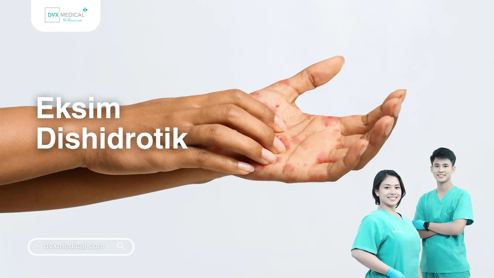 Eksim Dishidrotik