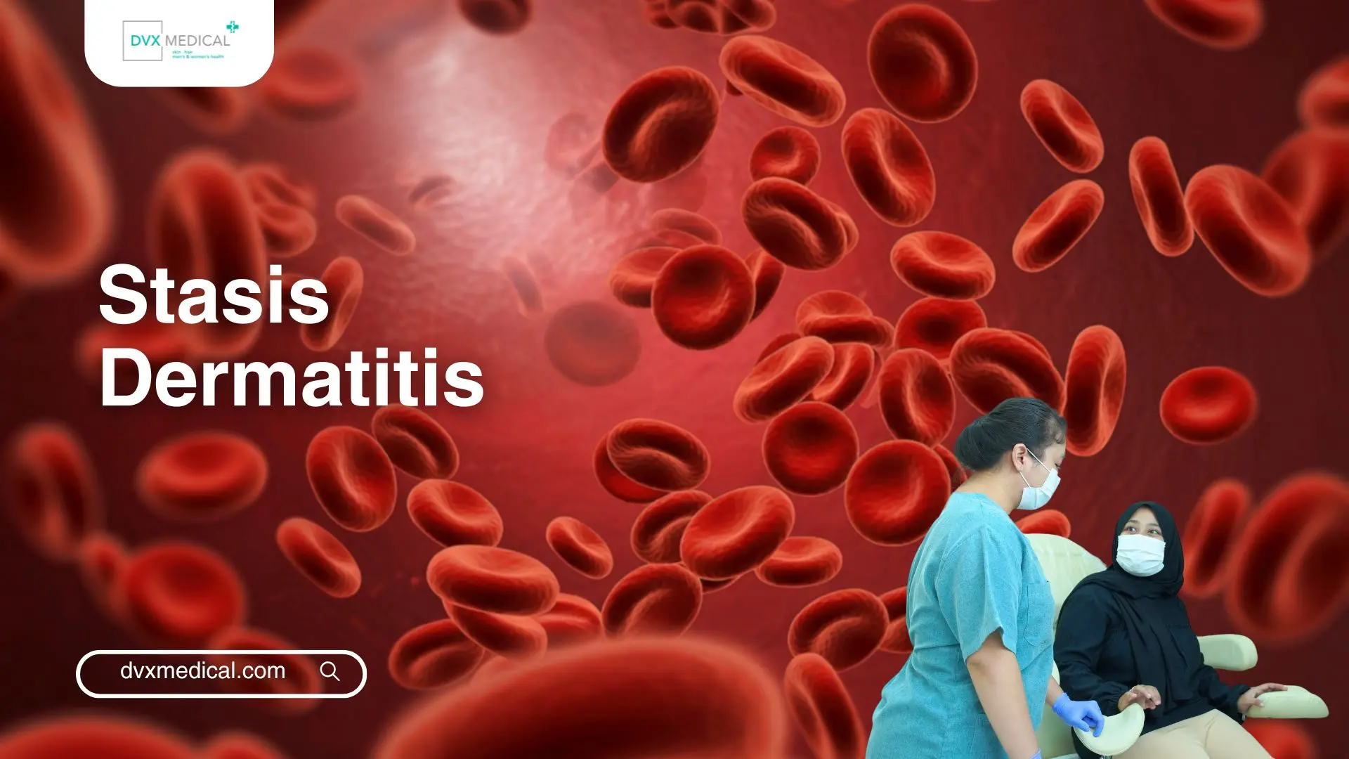 Stasis Dermatitis